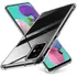 Capa Capinha Anti Choque Tpu Para Celular Samsung Galaxy A51