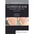Cicatrizes De Acne: Classificação E Tratamento, De Tosti, Antonella. Editorial Thieme Revinter Publicações Ltda, Tapa Dura En Português, 2019