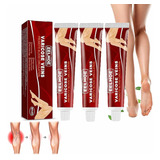 Creme Para Varizes Ajudam