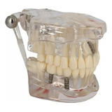 Dentista De Dentes De