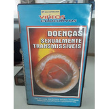 Doencas Sexualmente Transmissiveis 