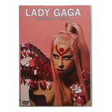 Dvd Duplo Lady Gaga