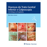 Ebook: Doenças Do Trato Genital Inferior E Colposcopia