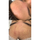 Estética Facial