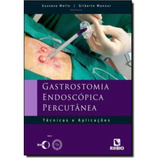 Gastrostomia Endoscopica Percutanea 