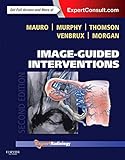Image guided Interventions 