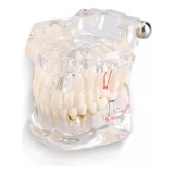 Implante Bucal Dentario Manequim