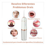 Irrigador Bucal Jato Fio Oral Limpa Aparelho Dental Slu Med