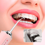 Irrigador Oral Elétrico Jato D Água Limpador Dental Bucal Cor Rosa 110v 220v