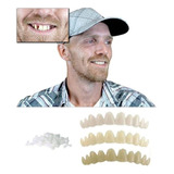 Kit 10 Dentes Para Encaixar Em