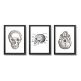 Kit 3 Quadros Decorativos Cranio Ortopedia