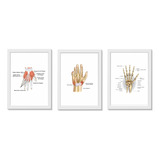 Kit 3 Quadros Decorativos Mão Ortopedia Fisioterapia