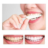 Lente Removível Superior E Inferior Snap On Smile par 