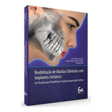 Livro Reabilitação De Maxilas Edêntulas Com Implantes Unitário Um Desafio Para Reabilitação Implantossuportada Estética 1 Edição 2023