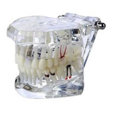 Manequim Modelo Molde Dentário Dental Boca