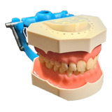 Dentes