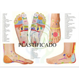 Plastificado