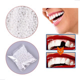 Massa Restauração Dente Quebrado Tampa Buraco Provisório