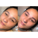 Micropigmentação E Estética Facial