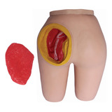Intramuscular
