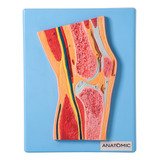 Anatomic
