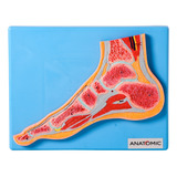 Anatomic