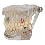 Modelo De Arcada Dentária Para Estudos