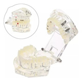 Modelo De Dentes De