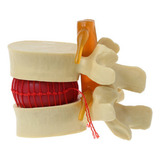 Vertebral