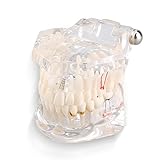 Modelo De Ensino De Doenças Dentárias Modelo De Dente Destacável Para Educação Odontológica E Ensino De Dente Modelo De Dente De Demonstração Typodont Adulto