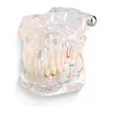 Modelo Dentário  Dentista De Dentes De Boca Cheia 