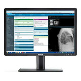 Monitor Hospitalar 24 Pol