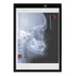 Negatoscópio Led Raio X Slim A4 Portatil Mesa Radiologia