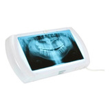 Negatoscópio Slim Panorâmico Biotron Preço Melhor