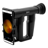 Eyescope