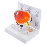 Olho Estudo Anatomia Catarata Modelo Ensino Médico Premium