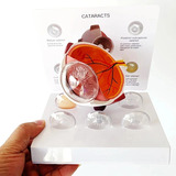 Olho Estudo Anatomia Catarata Modelo Ensino Médico Premium