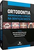 Ortodontia Abordagens Clínicas Na Dentição Mista
