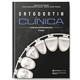 Ortodontia Clínica Tratamento Com Aparelhos Fixos