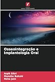Osseointegracao E Implantologia Oral