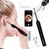 Otoscópio Digital Wifi S fio Mini Cãmera Recarrega Médico