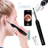 Otoscópio Digital Wifi S fio Mini Cãmera Recarrega Médico