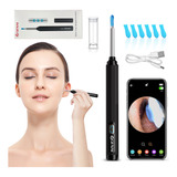 Otoscópio Digital Wifi Sem Fio Mini Câmera Recarregável