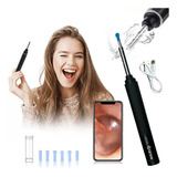 Otoscópio Digital Wifi Sem Fio Mini Câmera Recarregável