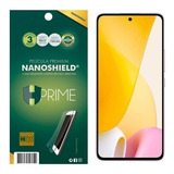 Película Premium Hprime Nanoshield Para Xiaomi
