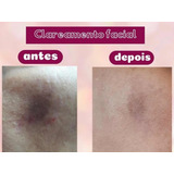 Pelling Ácido Retinoico 40 20ml mega Promoção 