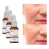 Pós Dermaroller Microagulhamento Peeling Kit 3 Séruns Sh