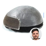 1b