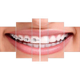 Quadro Decorativo Consultório Odonto Dentista Aparelho