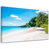 Quadro Para Sala De